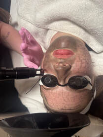 Carbon Facial Clearfield