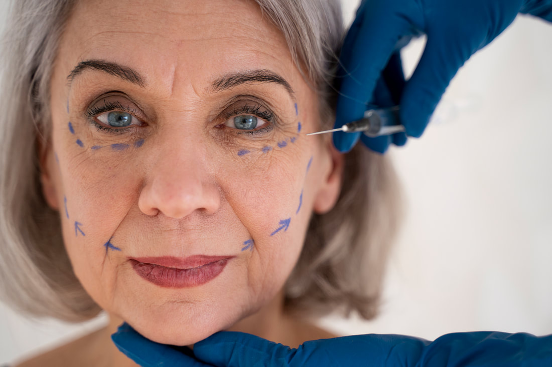 Botox and Dysport